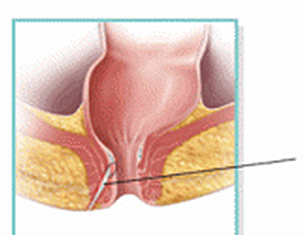 答案虽是肯定的却也不太一样_进行_肛门_检查