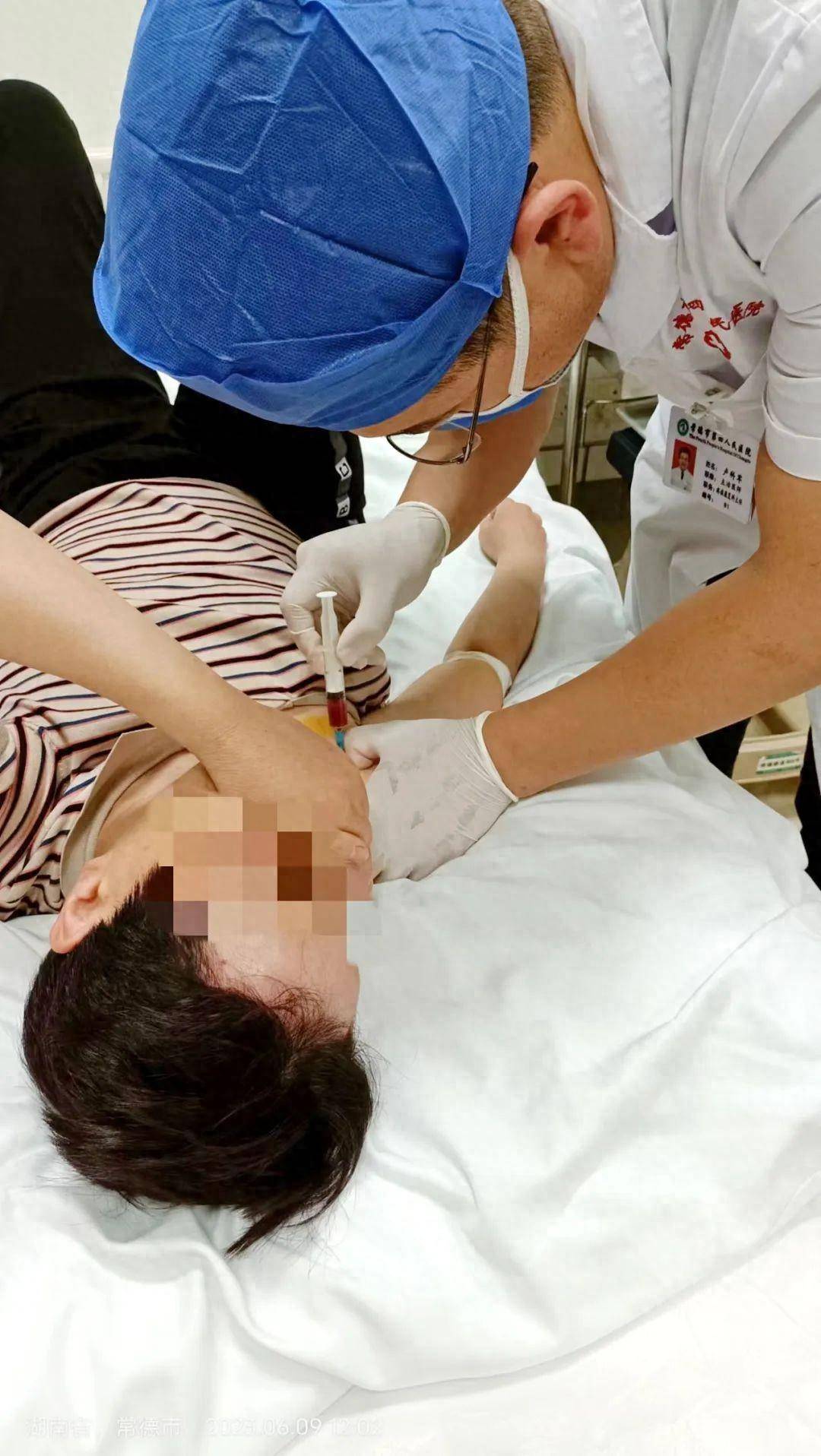 星状神经节阻滞技术解决众多耳鸣患者困扰