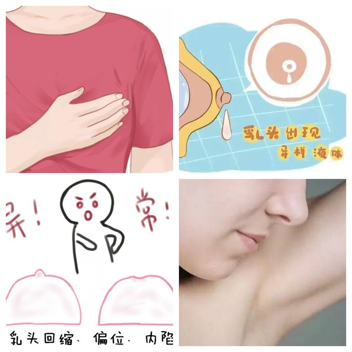 乳腺癌是一种可以预防和治愈的疾病