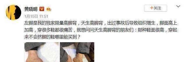 原创被指身高180cm是垫了增高鞋垫黄晓明晒脚背照回应脚受过伤