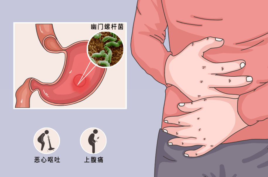 如何预防幽门螺旋杆菌感染?