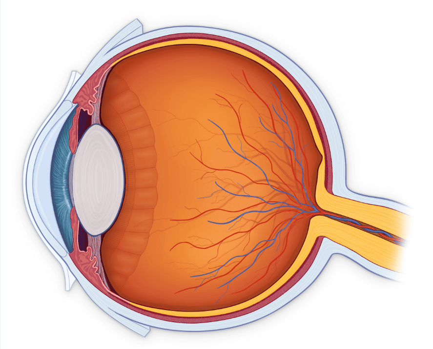 白内障不会"缺席"只会"迟到"?光明更重要_手术_晶状体_治疗