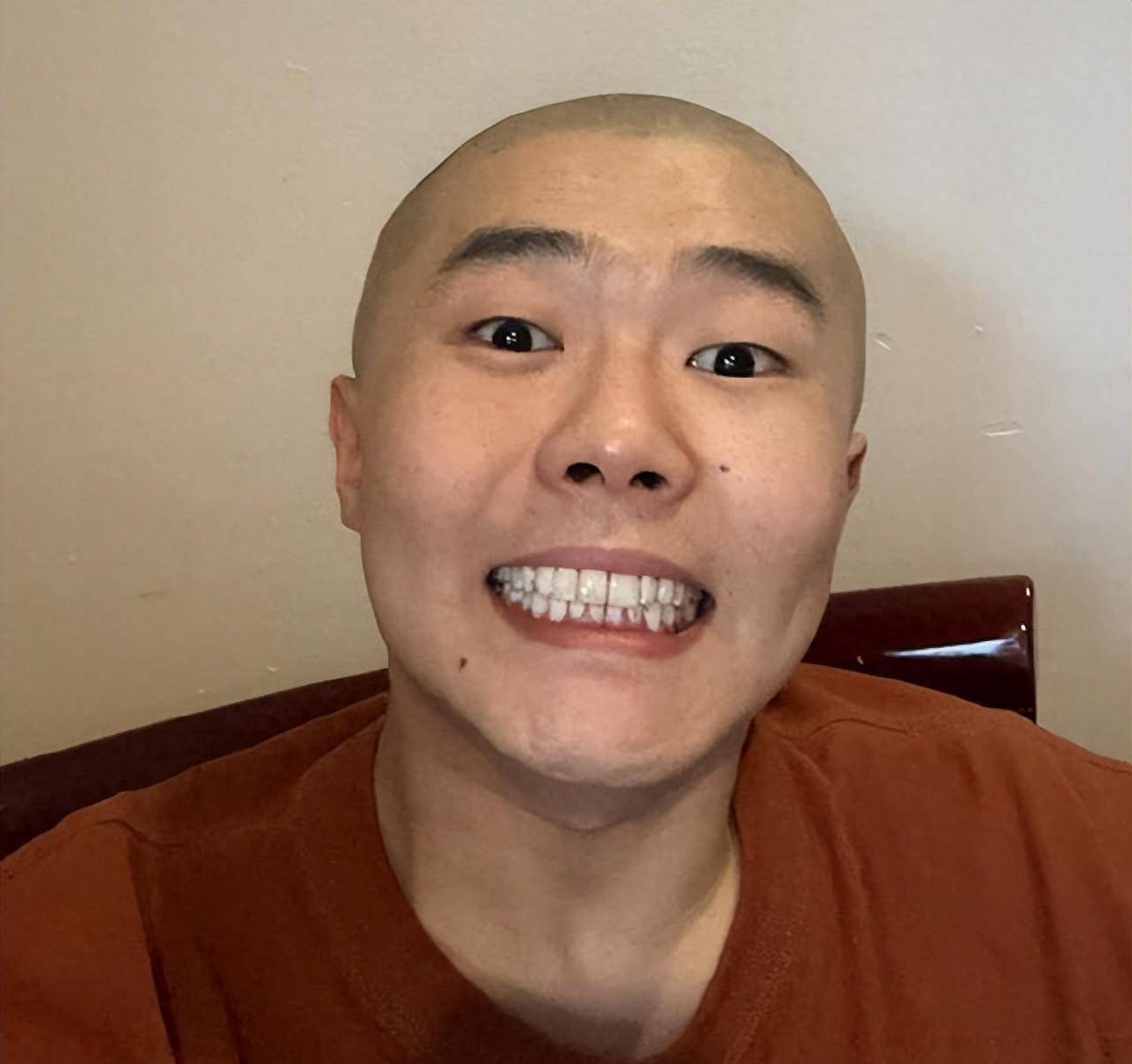 德云社周九良横店拍戏晒光头照引热议十几分钟评论就破千了