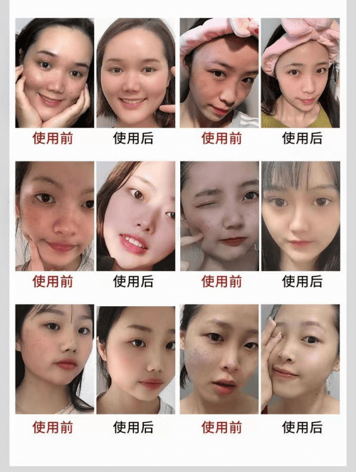 怎样有效祛斑淡斑祛斑效果排名第一护肤品点评