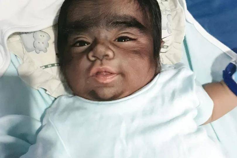 据介绍,现年两岁的加伦出生时毛发浓密,鬓角,面部,颈部,背部和手臂上