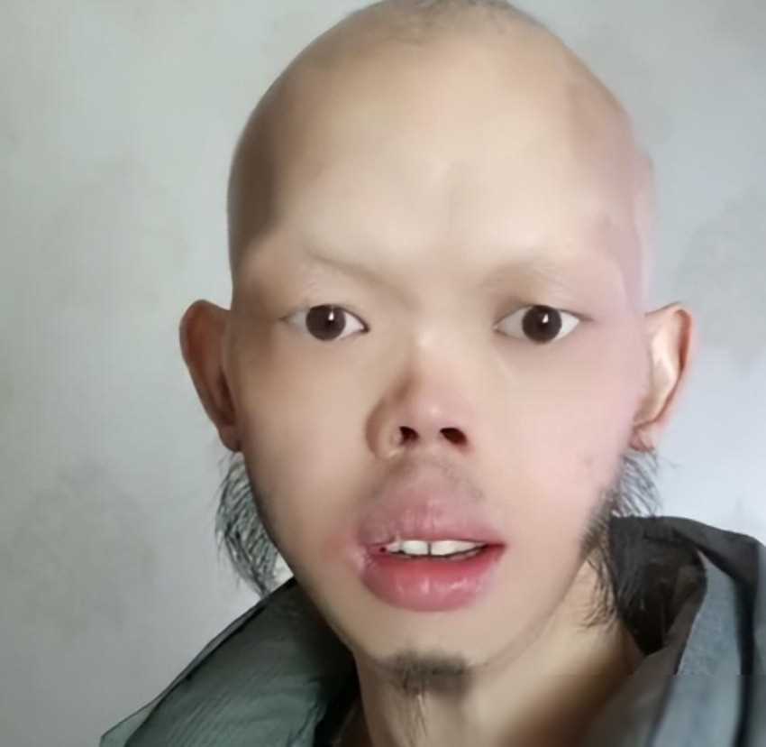 他逐渐获得了更多的机会,最终成为了备受瞩目的特型演员