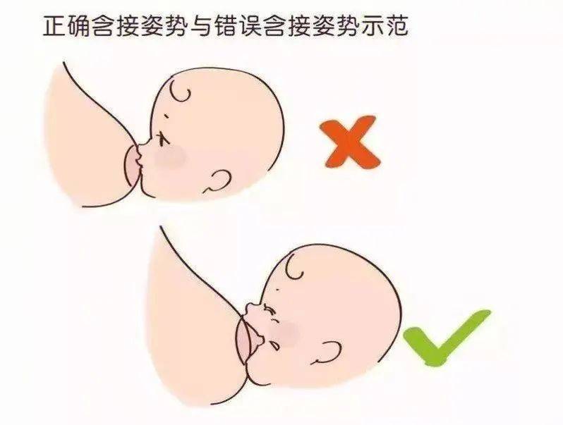 切除乳房母乳喂养图片