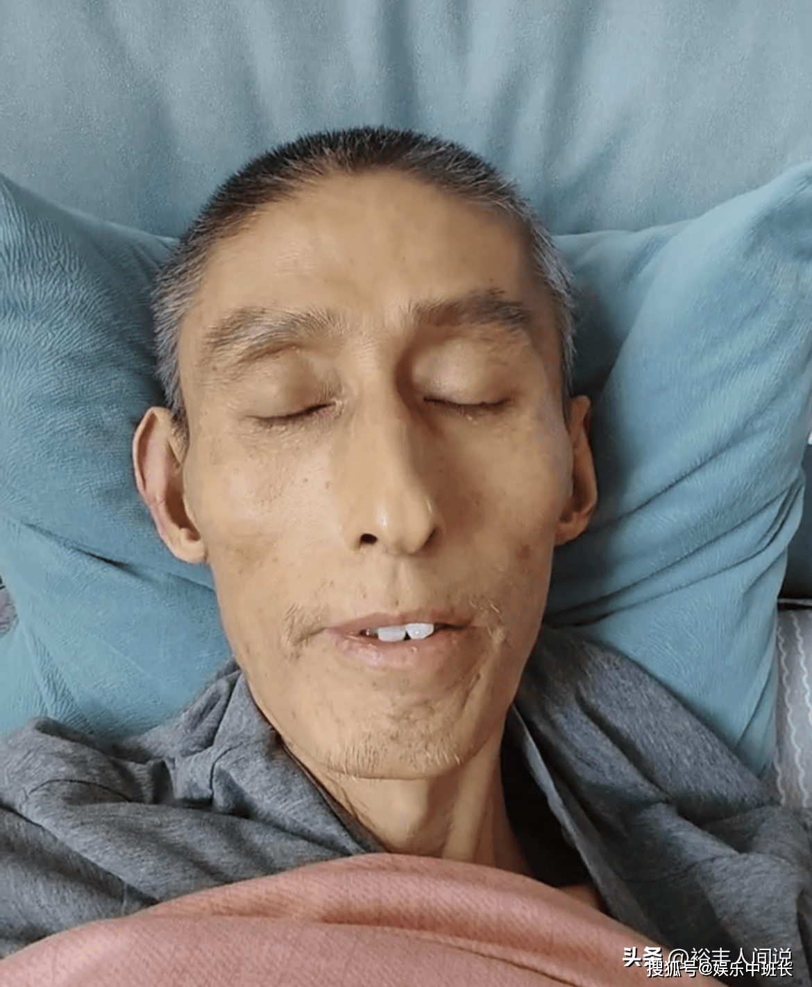 原创47岁网红毛毛去世三年化疗瘦到脱相模样似80岁惹人感慨