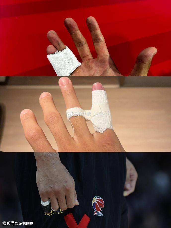 这才是cba硬汉韧带撕裂加上手指骨折带伤淘汰对手深圳国手