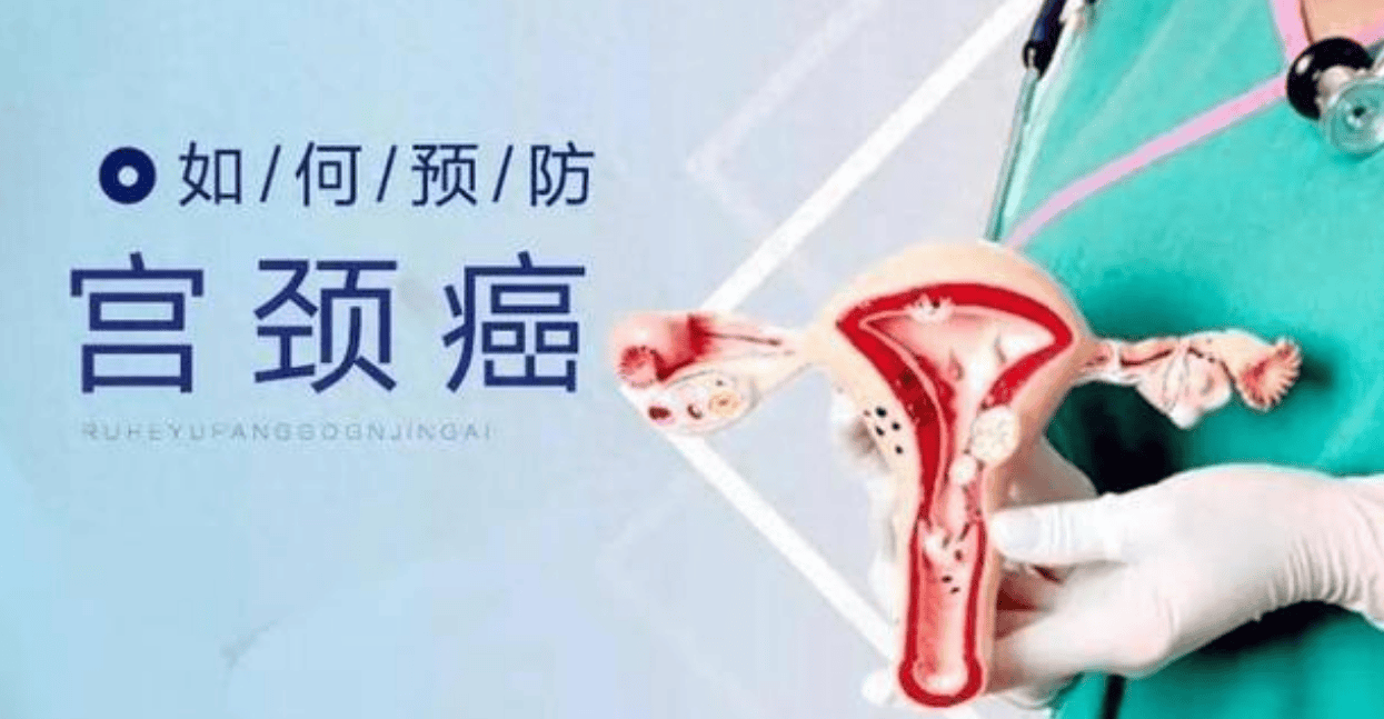 哪些人容易被宫颈癌盯上?_女性_免疫_筛查