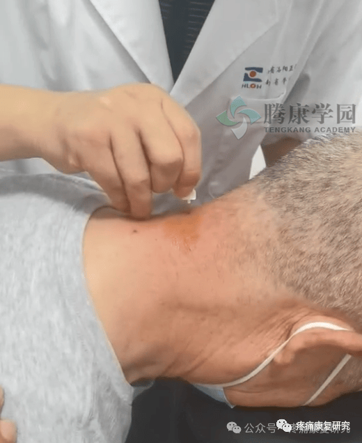 有一种眩晕叫耳石症可以从哪些方面来鉴别