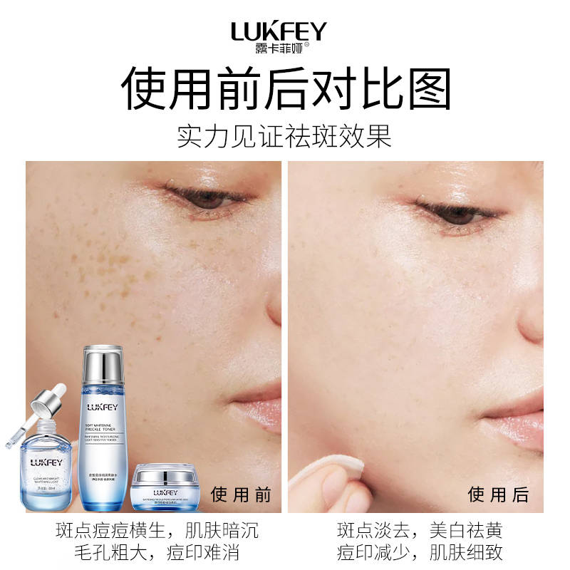 高效祛斑美白祛斑抗衰老提亮护肤品排行榜这五款很热门