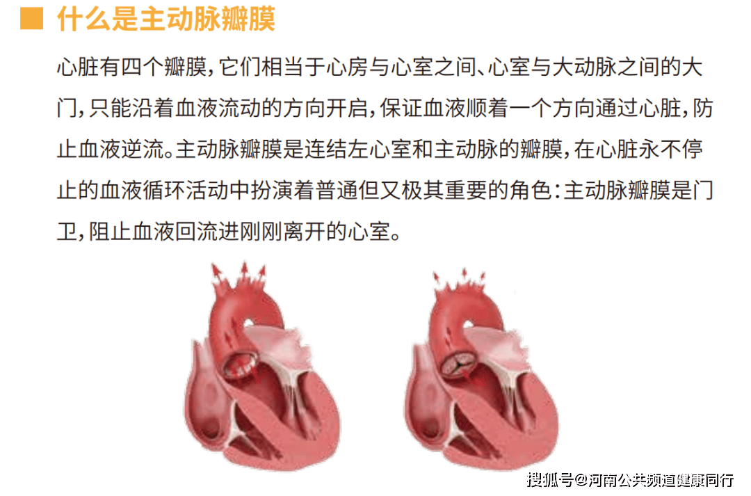 主动脉瓣膜发生狭窄时,心脏的血液流动受阻,心脏向身体各器官供血不足