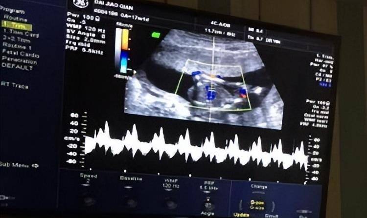 2019年女子备孕10年没怀上,腹痛去医院看病,医生:你马上要生了