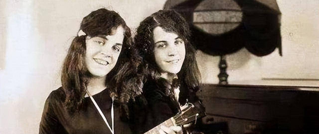 臀部连体姐妹:无法正常结婚,姐姐死后,妹妹与遗体共存2天去世