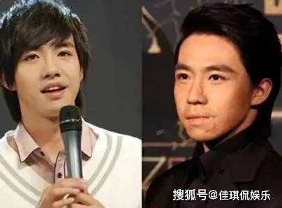 像胡歌,王心凌,俞灏明等.娱乐圈因事故毁容的明星,不在少数.