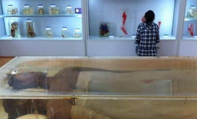 湖南"女巨人",14岁身高二米四,却在18岁猝死,死后被开膛破肚