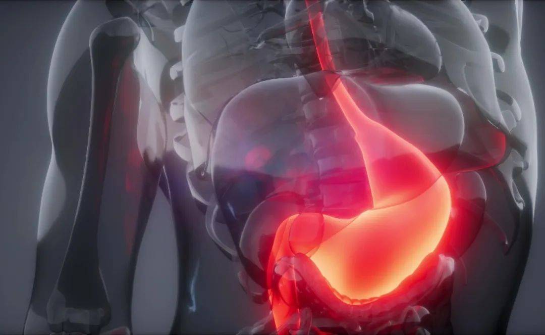 【广州建康医院】胃食管反流,真不是那么简单