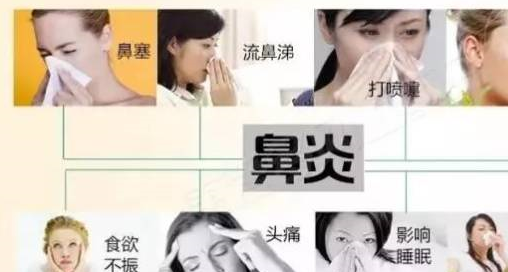过敏性鼻炎传染吗 来自搜狐网
