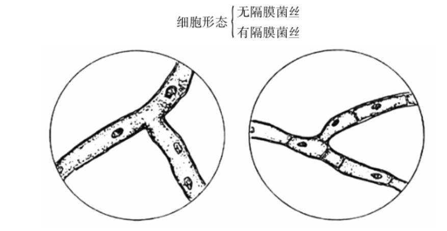 放线菌100倍手绘图图片