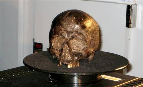 进一步检测分析后发现,这颗大脑中用于支撑神经和脑细胞结构的蛋白质