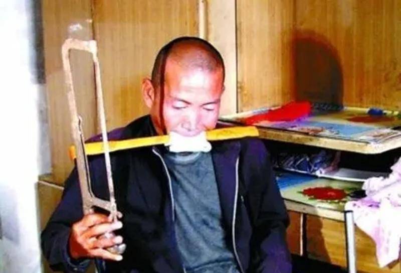 河北硬汉郑艳良,为省下百万手术费自锯右腿,如今重获新生