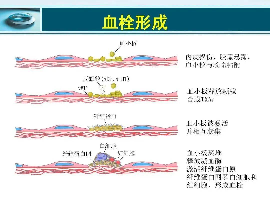 血栓形成与肠道菌群 不容忽视的健康隐患