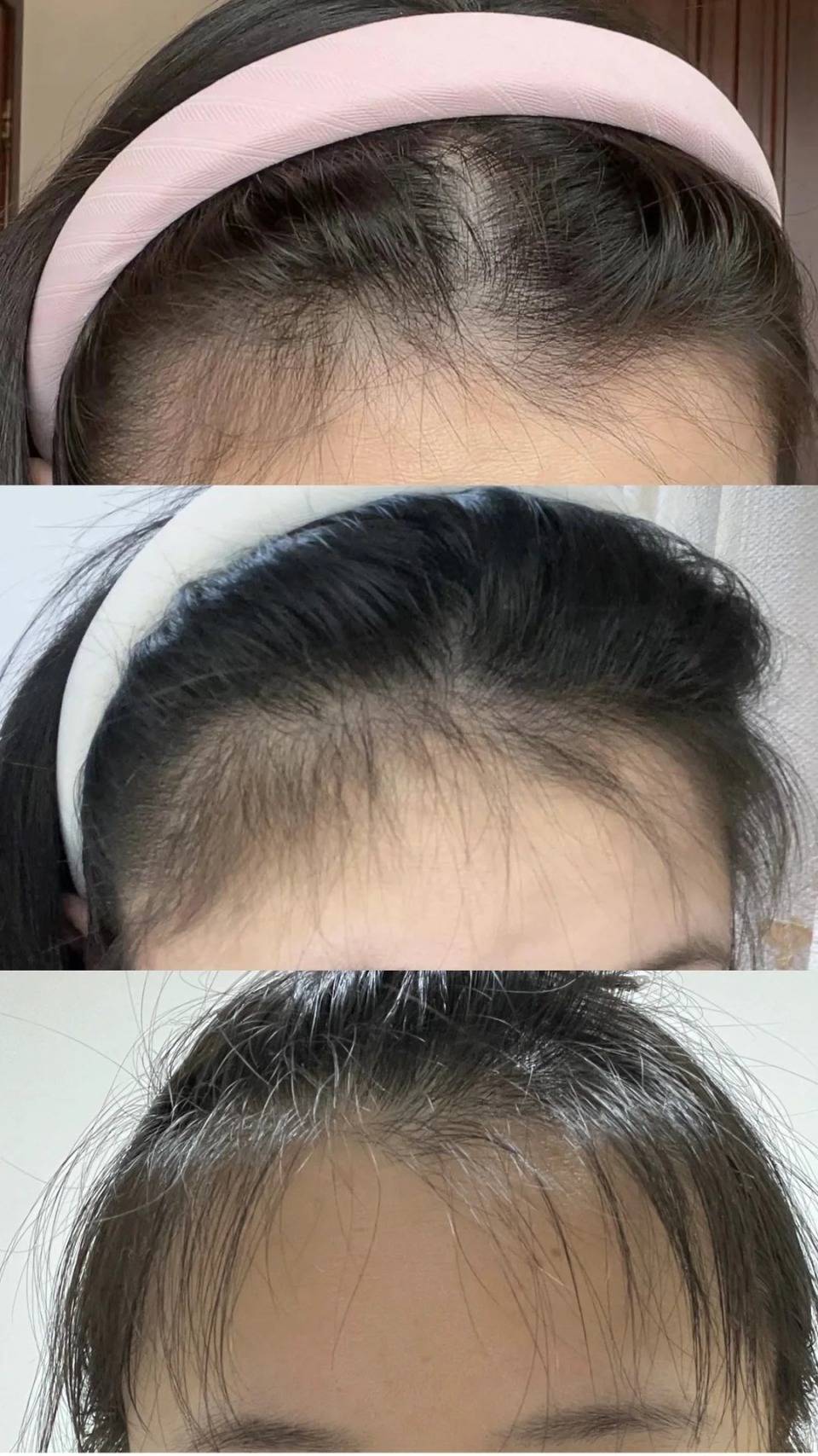 防脱生发十大品牌排名榜:榜一夏天必囤,固发养发一手抓_头发_精华