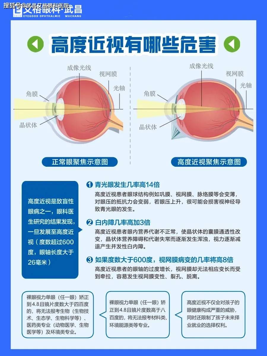 护眼急报:高度近视的三大危害