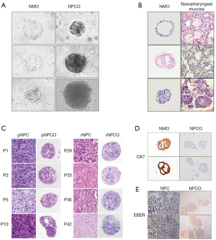 成功率超80%!建立鼻咽癌患者衍生类器官模型和活体生物库