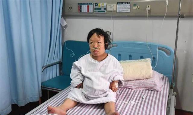 2017年南宁93厘米袖珍女怀孕37周,蜗居10平米出租屋,后冒死产子