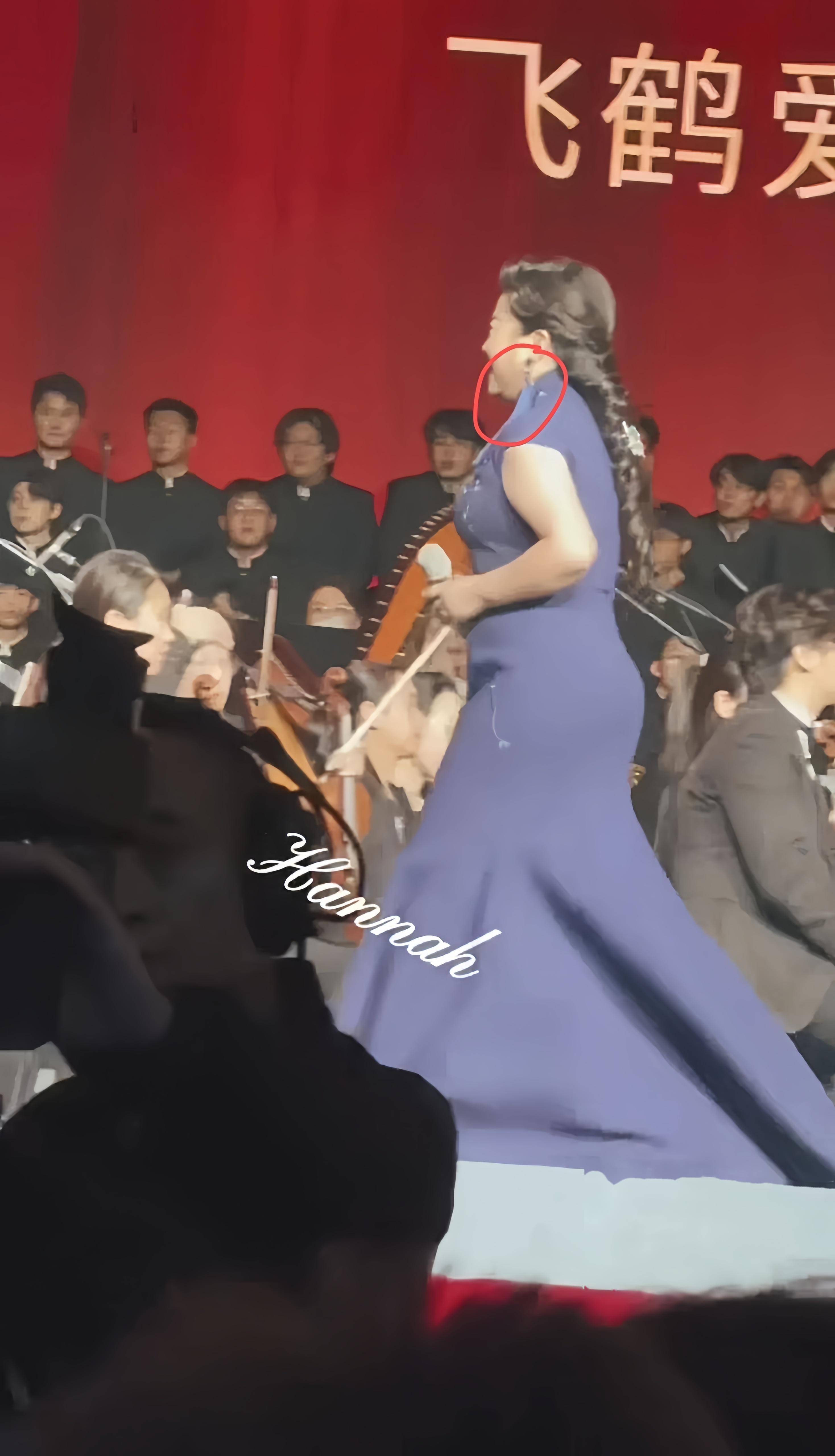 56岁张也演出近照曝光,身材臃肿肚子胀大,穿长裙脖子粗短显笨重