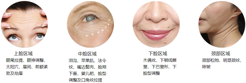 针刀美容,埋线减肥,线雕提升技术班 2024年7月11日.郑州