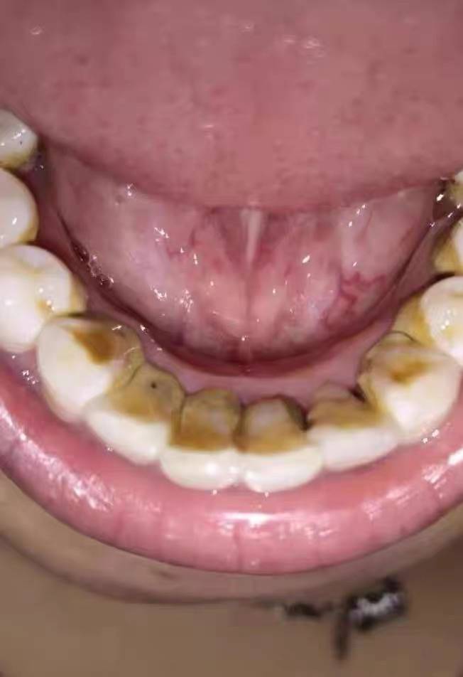 口腔_牙齿_时候