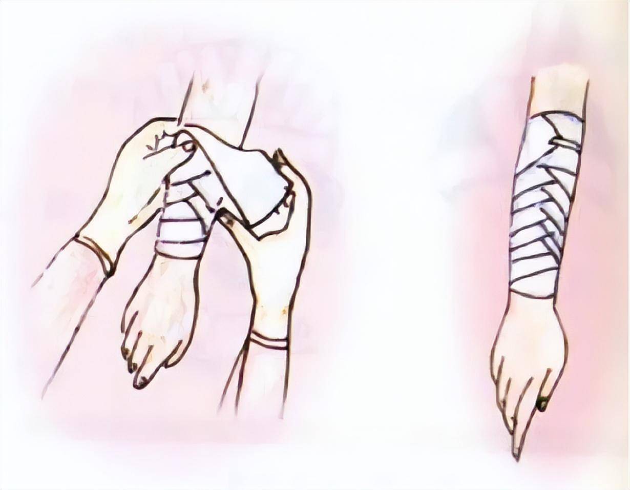 绷带如何包扎