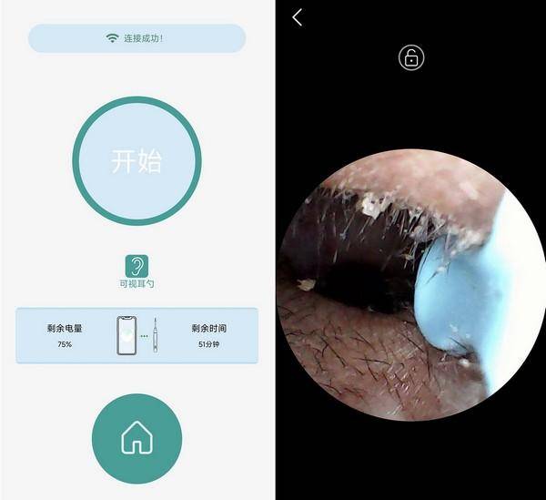 不用去采耳店,西圣Find智能可视挖耳勺让你拥有智能掏耳新体验