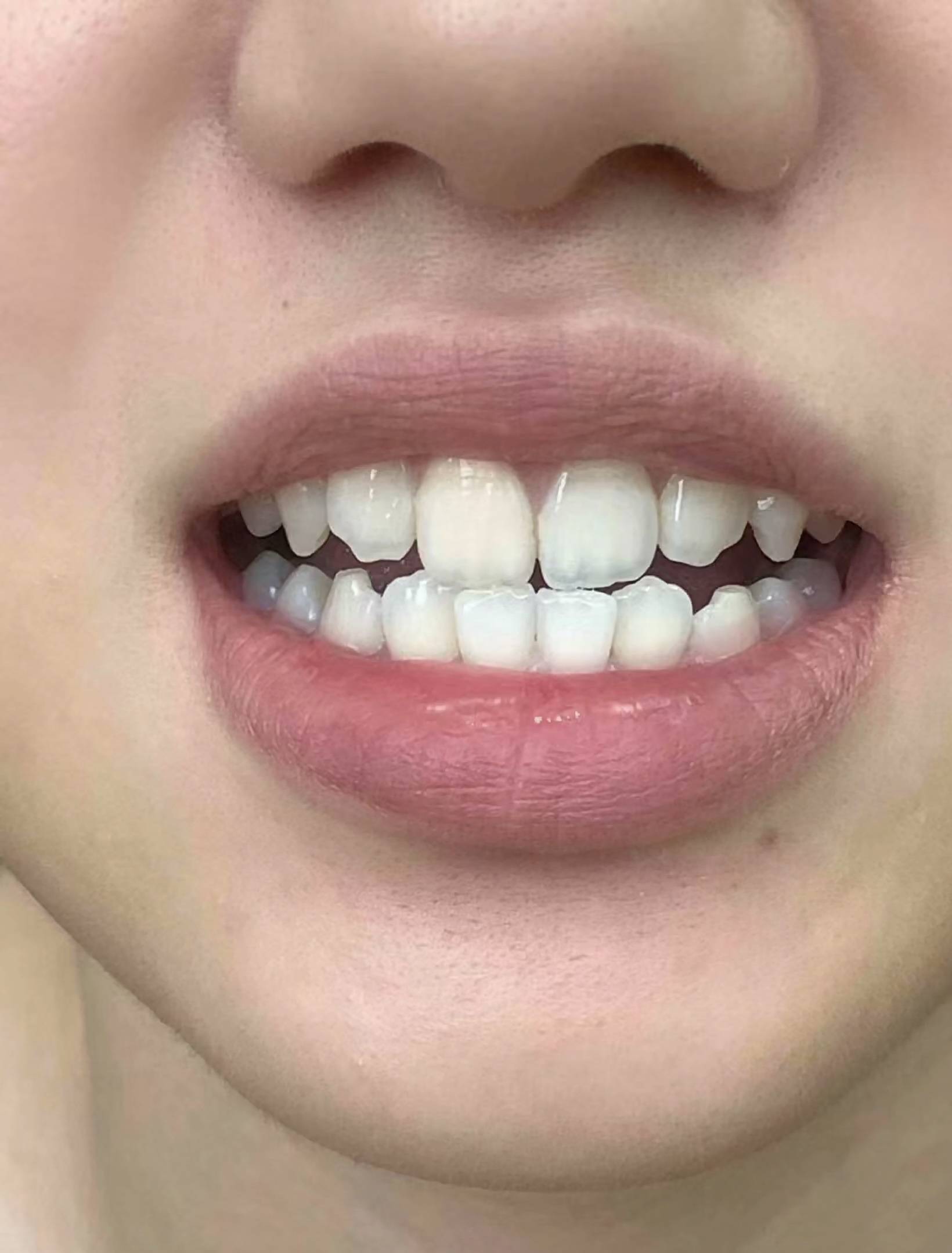 自用的白牙妙招赶紧学会,黄牙光速变白牙!