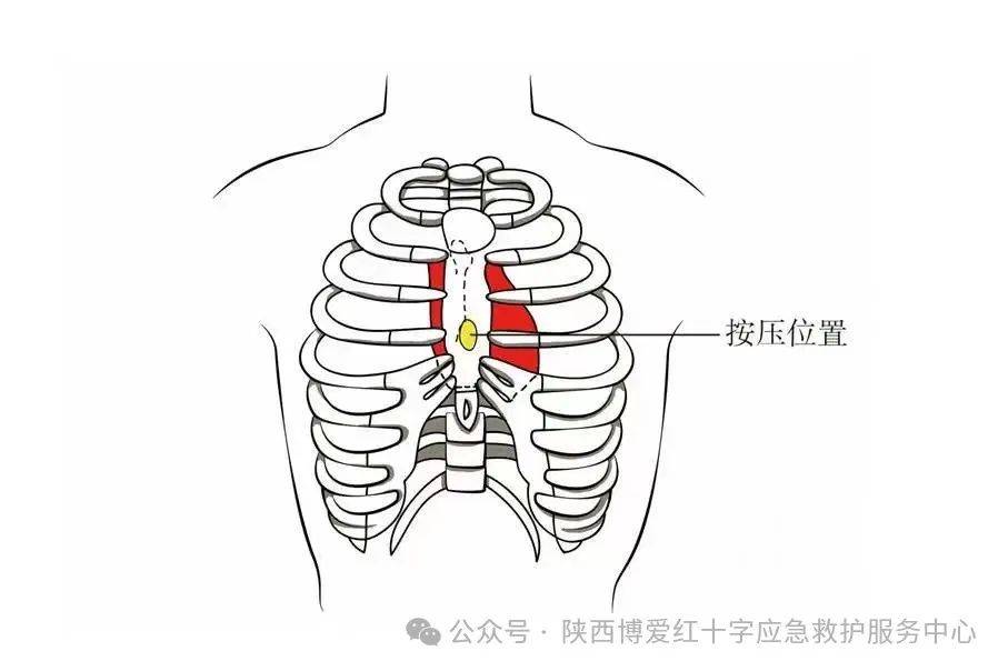 用仰头举颏法开放气道,通常使患者下颌角及耳垂的连线与水平面垂直