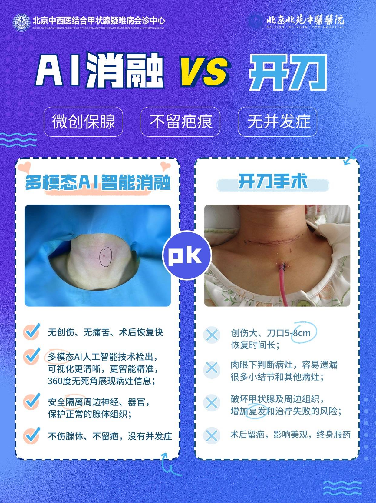精益求精,极致微创—北京北苑中医院一针除掉甲状腺结节