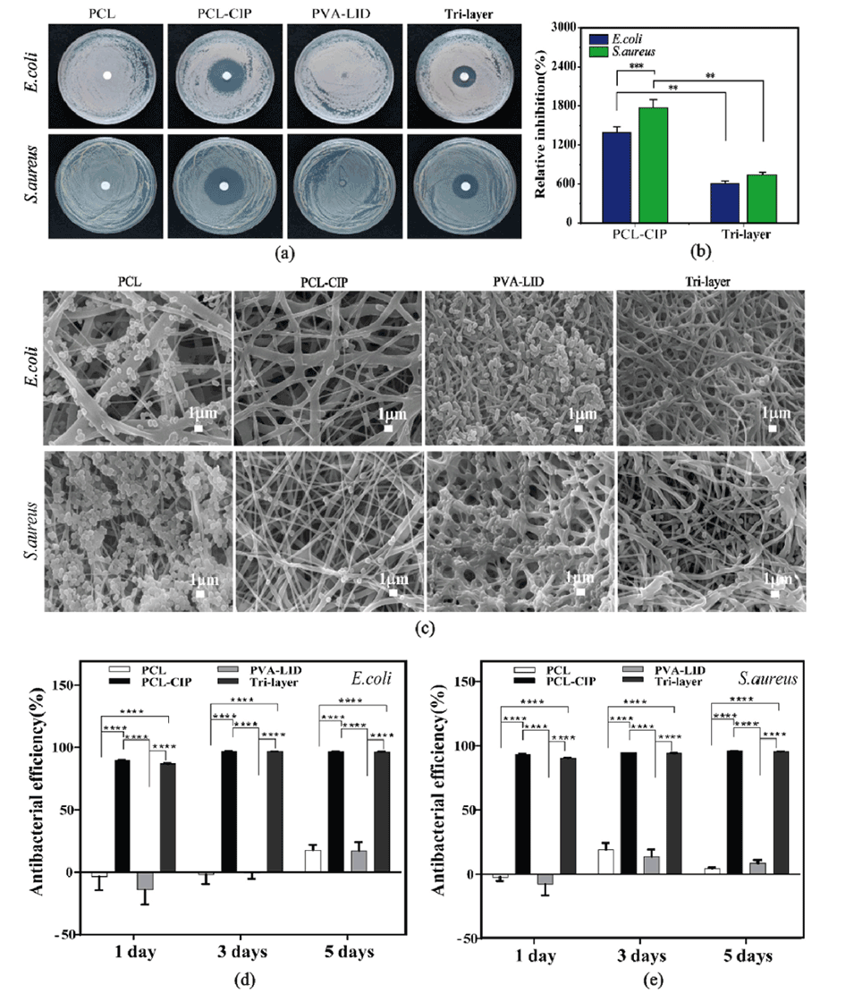 河北工业夏丹副教授等人:具有非对称润湿性的三层纳米纤维敷料,用于