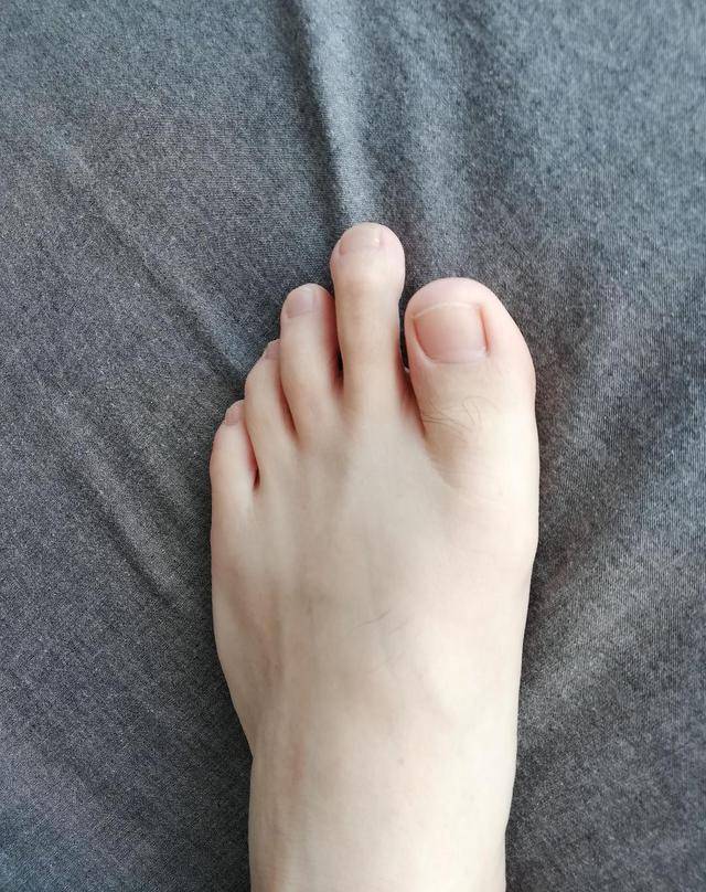 而且古人普遍认为第二个脚趾头的长度如果大于第一个脚趾头的