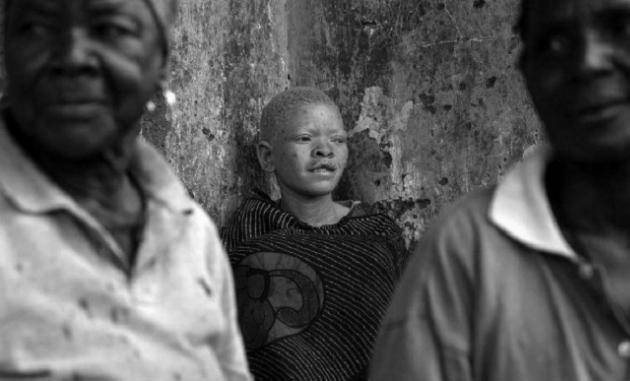 非洲"最"珍贵的一类黑人,血液比黄金还贵,24小时受警察保护