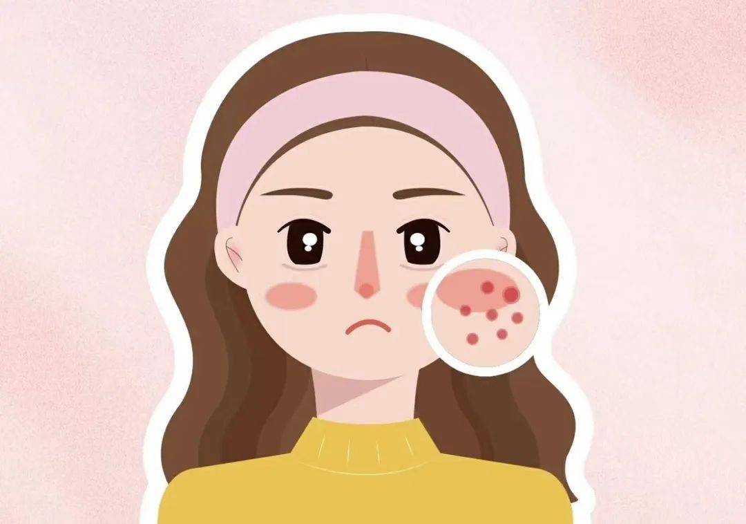 如果你中了3个以上,那你就是"油痘肌"了肤色蜡黄,暗沉,无光泽特别在