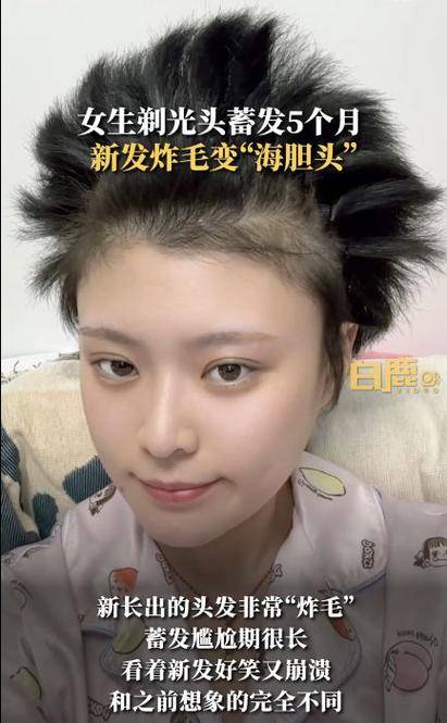 女生剃光头蓄发5个月炸毛似海胆-女士剃光头