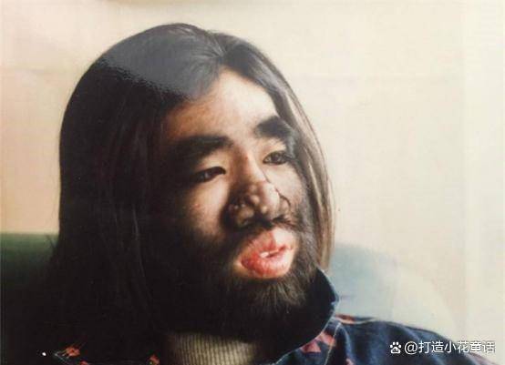 "毛孩"于震寰浑身长满毛,被投资1000万包装