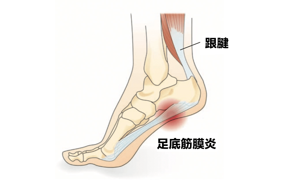 亳骨足踝日 7月29日亳州骨科医院持续开启