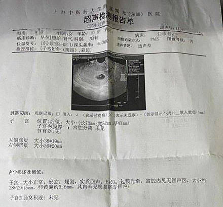 25岁女学生"自曝"为导师堕胎,学校:立即解聘!