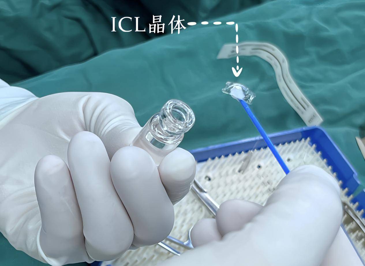 激光类近视手术和晶体植入近视手术的区别是什么?