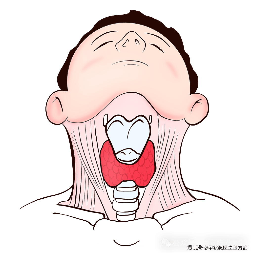 (科普)桥本氏甲状腺炎的表现及患者在日常生活中需要注意的事项