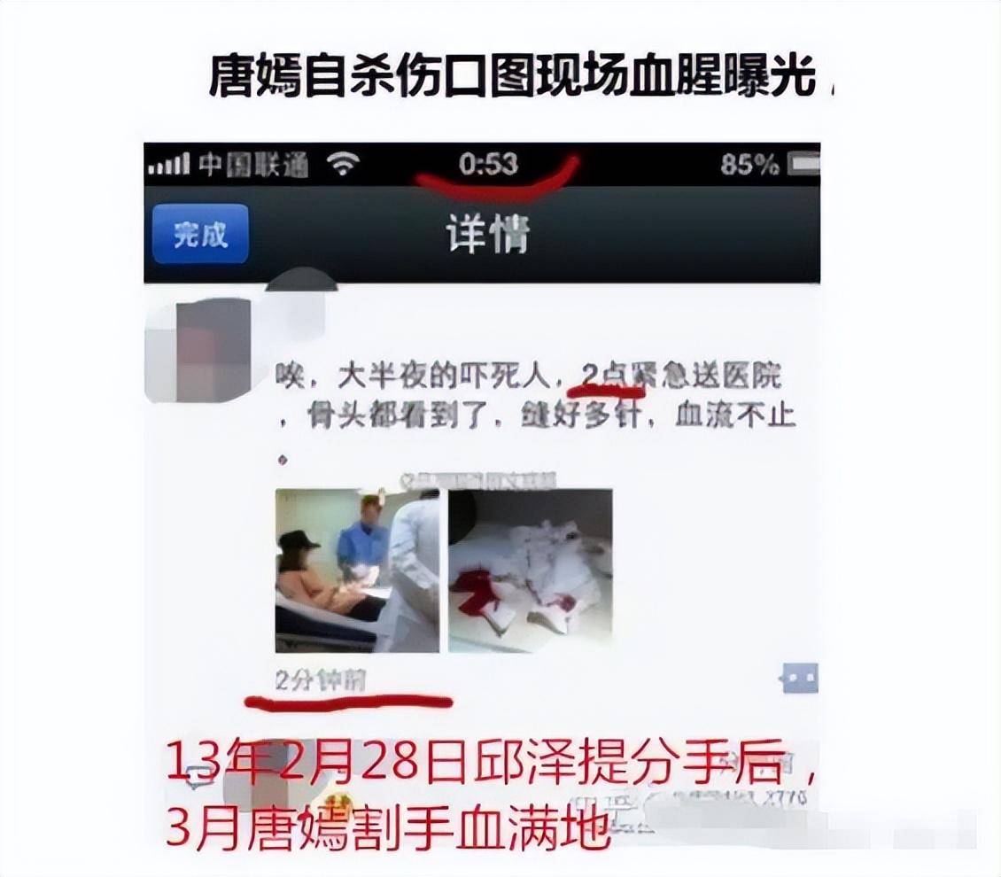 割脉会死吗图片